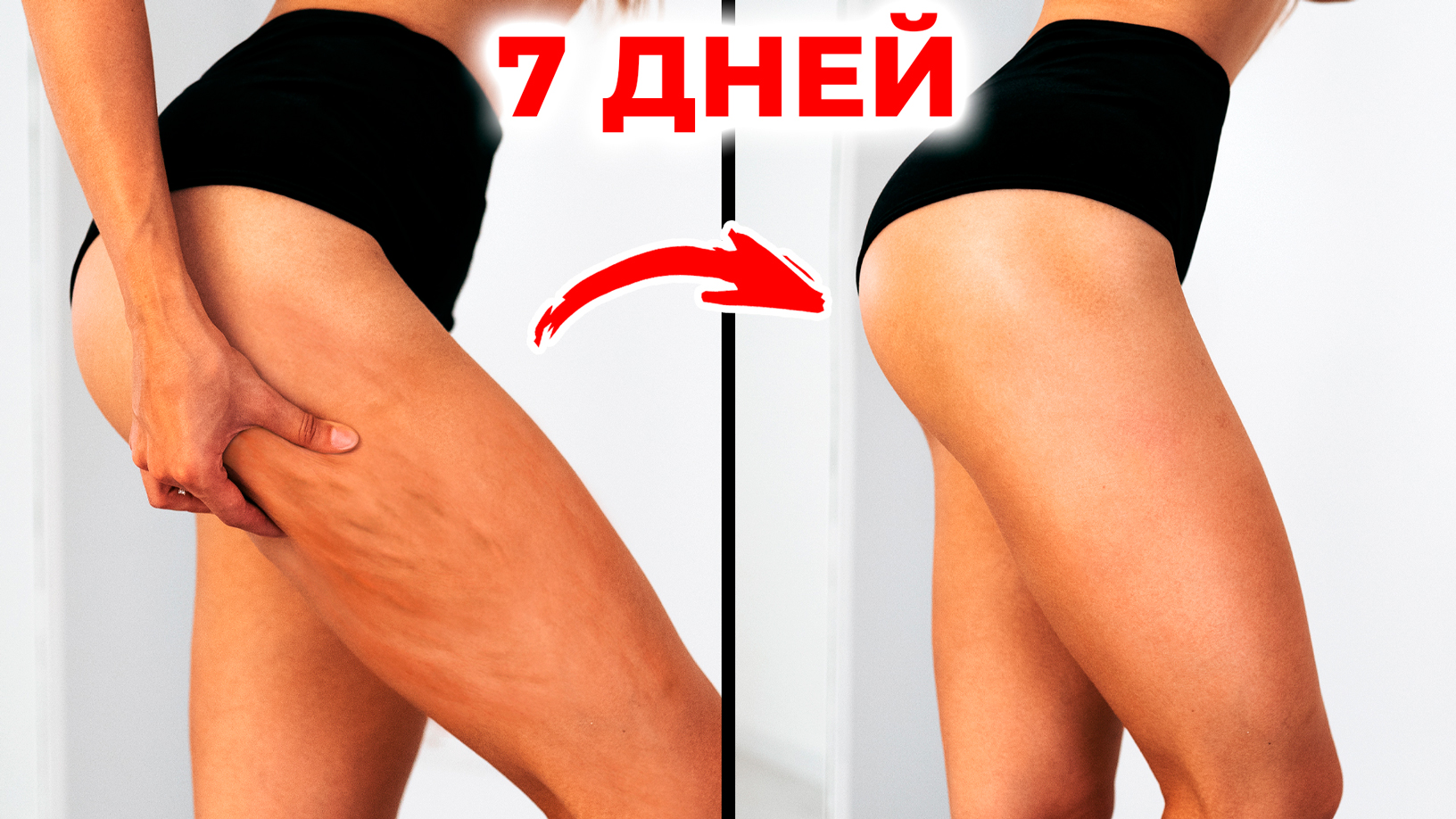 КАК ИЗБАВИТЬСЯ ОТ ЦЕЛЛЮЛИТА - Эффективная Домашняя Тренировка